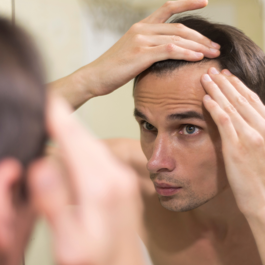 Cómo evitar la caída del cabello en hombres