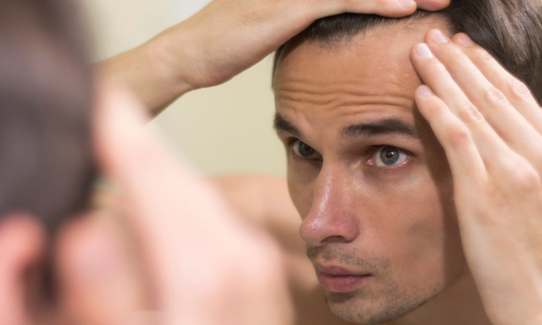 Cómo evitar la caída del cabello en hombres