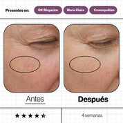 ANP Skin Ultimate 28 Días