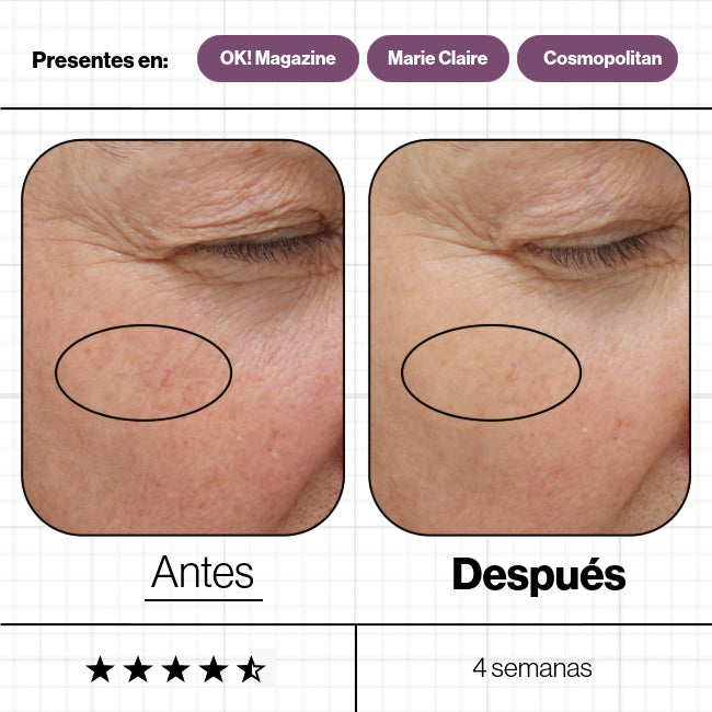 ANP Skin Ultimate 28 Días